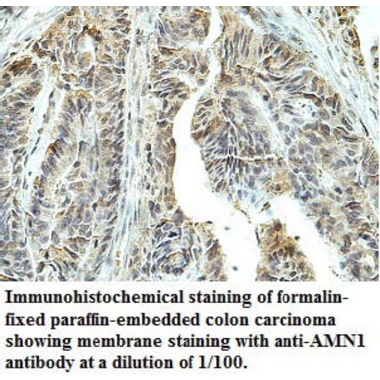 AMN1 Antibody from Signalway Antibody (39755) - Antibodies.com