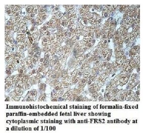 FRS2 Antibody from Signalway Antibody (39944) - Antibodies.com