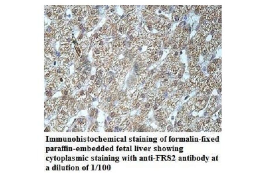 FRS2 Antibody from Signalway Antibody (39944) - Antibodies.com