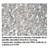 FRS2 Antibody from Signalway Antibody (39944) - Antibodies.com