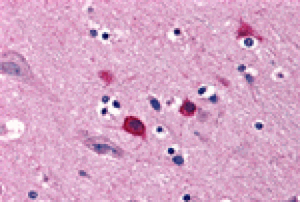 Immunohistochemistry - BOK Antibody from Signalway Antibody (24253) - Antibodies.com