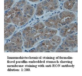 RON Antibody from Signalway Antibody (39332) - Antibodies.com