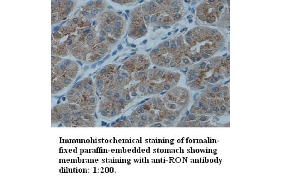 RON Antibody from Signalway Antibody (39332) - Antibodies.com