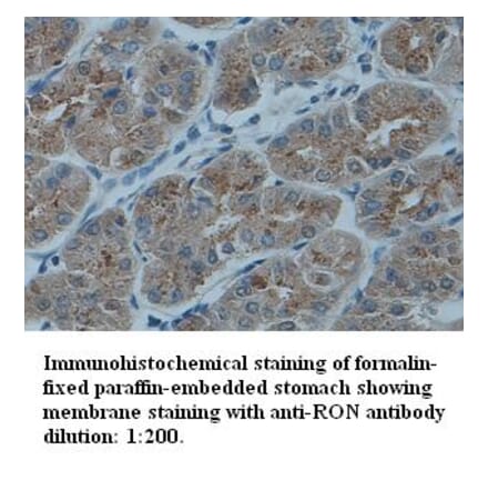 RON Antibody from Signalway Antibody (39332) - Antibodies.com