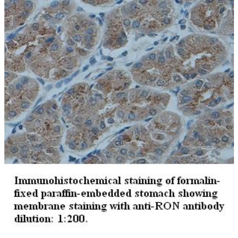 RON Antibody from Signalway Antibody (39332) - Antibodies.com