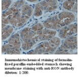 RON Antibody from Signalway Antibody (39332) - Antibodies.com