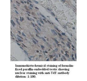 TdT Antibody from Signalway Antibody (39341) - Antibodies.com