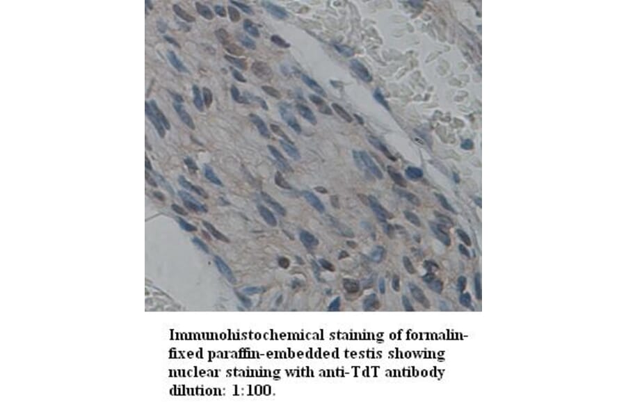 TdT Antibody from Signalway Antibody (39341) - Antibodies.com