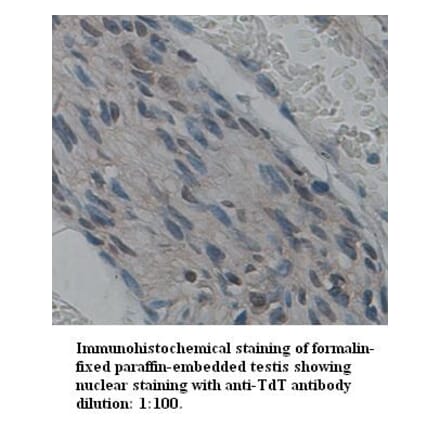 TdT Antibody from Signalway Antibody (39341) - Antibodies.com
