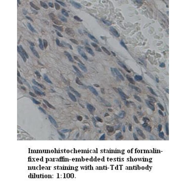 TdT Antibody from Signalway Antibody (39341) - Antibodies.com