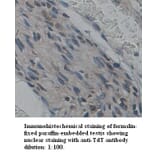 TdT Antibody from Signalway Antibody (39341) - Antibodies.com