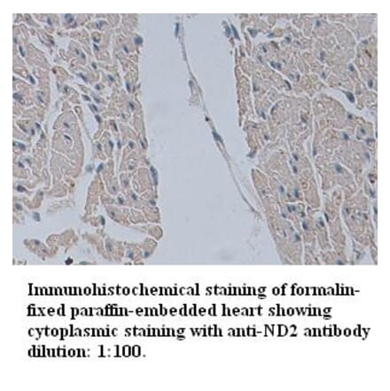 ND2 Antibody from Signalway Antibody (39343) - Antibodies.com