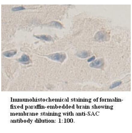 SAC Antibody from Signalway Antibody (39345) - Antibodies.com