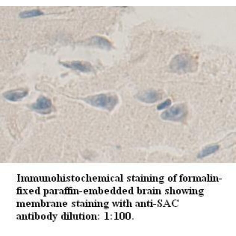 SAC Antibody from Signalway Antibody (39345) - Antibodies.com