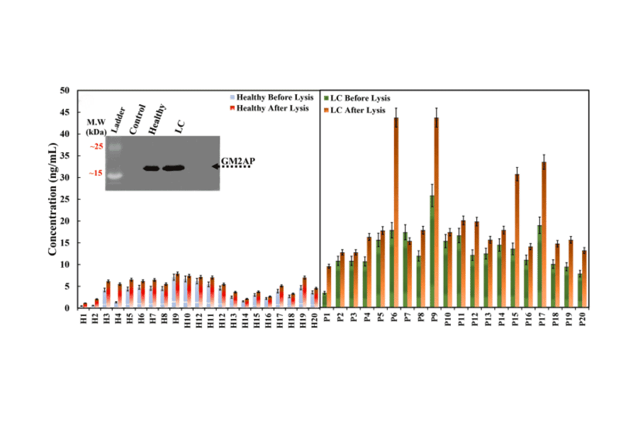 ELISA - Human GM2A ELISA Kit (A5238) - Antibodies.com Citation