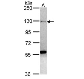 zinc finger protein 574 antibody from Signalway Antibody (22528) - Antibodies.com