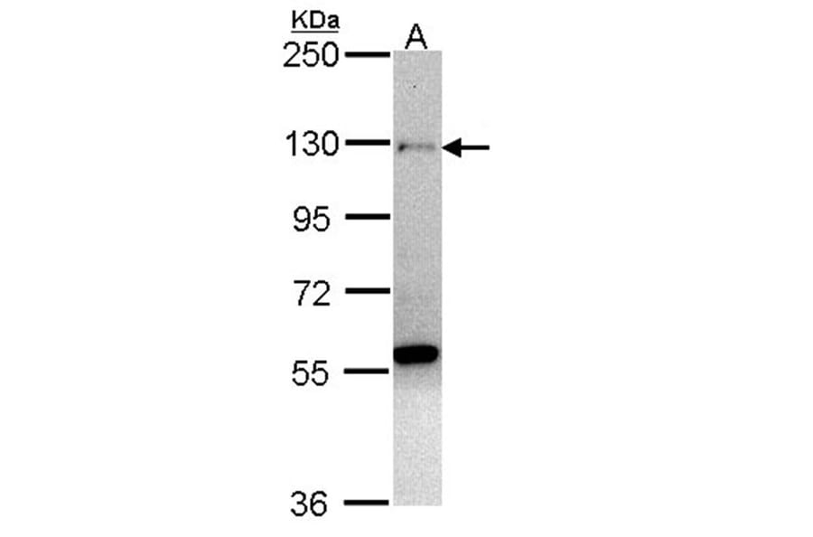 zinc finger protein 574 antibody from Signalway Antibody (22528) - Antibodies.com