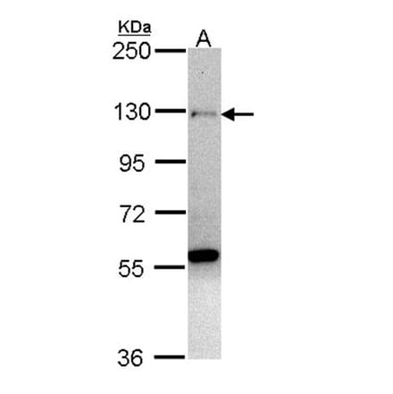 zinc finger protein 574 antibody from Signalway Antibody (22528) - Antibodies.com