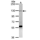 zinc finger protein 574 antibody from Signalway Antibody (22528) - Antibodies.com