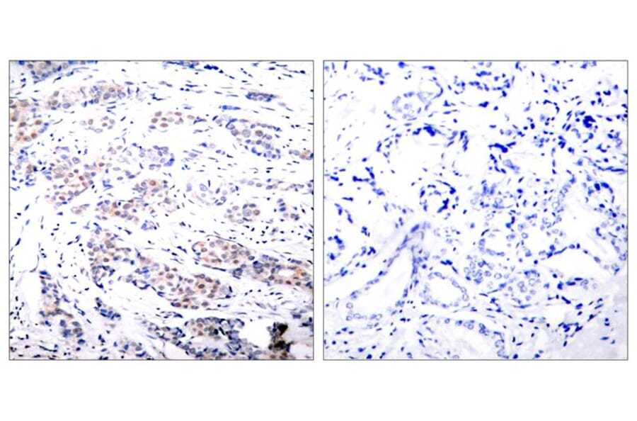 Immunohistochemistry - Elk-1 (Ab-383) Antibody from Signalway Antibody (21004) - Antibodies.com