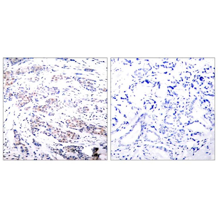 Immunohistochemistry - Elk-1 (Ab-383) Antibody from Signalway Antibody (21004) - Antibodies.com