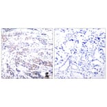 Immunohistochemistry - Elk-1 (Ab-383) Antibody from Signalway Antibody (21004) - Antibodies.com