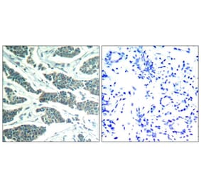 Immunohistochemistry - AKT1/AKT2/AKT3 (Ab-315/316/312) Antibody from Signalway Antibody (21501) - Antibodies.com