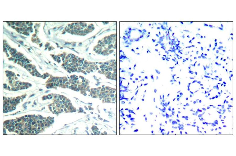 Immunohistochemistry - AKT1/AKT2/AKT3 (Ab-315/316/312) Antibody from Signalway Antibody (21501) - Antibodies.com