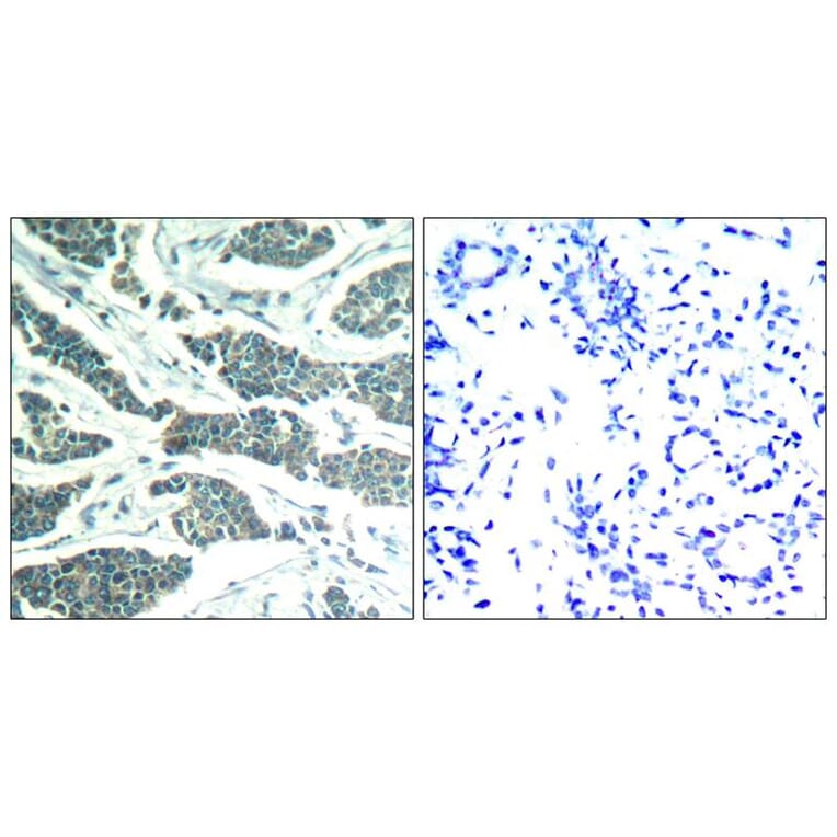 Immunohistochemistry - AKT1/AKT2/AKT3 (Ab-315/316/312) Antibody from Signalway Antibody (21501) - Antibodies.com