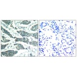 Immunohistochemistry - AKT1/AKT2/AKT3 (Ab-315/316/312) Antibody from Signalway Antibody (21501) - Antibodies.com
