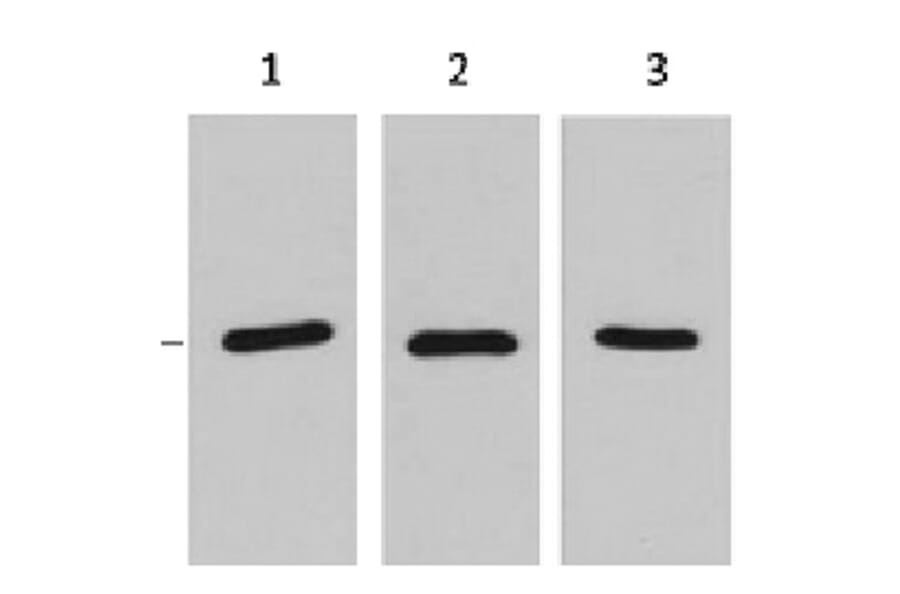 RFP-Tag Mouse Monoclonal Antibody from Signalway Antibody (T608) - Antibodies.com