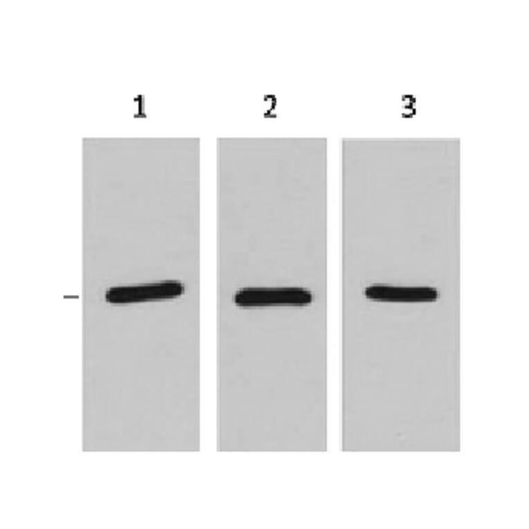 RFP-Tag Mouse Monoclonal Antibody from Signalway Antibody (T608) - Antibodies.com