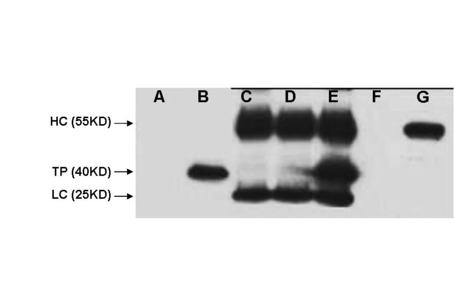 V5-Tag Mouse Monoclonal Antibody from Signalway Antibody (T605) - Antibodies.com