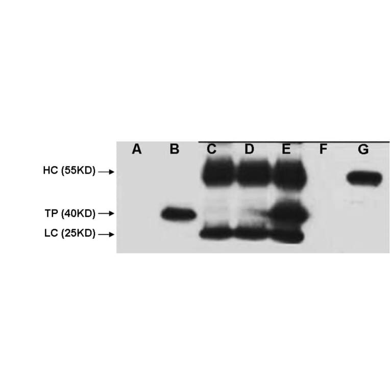 V5-Tag Mouse Monoclonal Antibody from Signalway Antibody (T605) - Antibodies.com