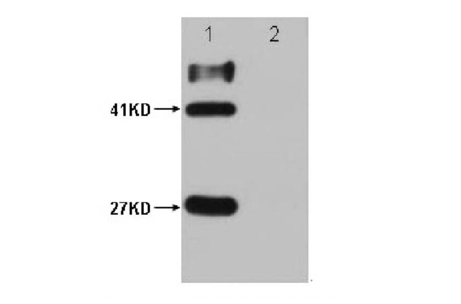 HSV-Tag Mouse Monoclonal Antibody from Signalway Antibody (T607) - Antibodies.com