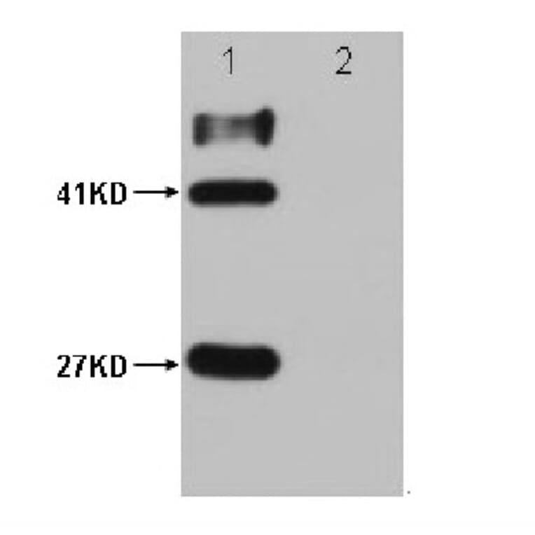 HSV-Tag Mouse Monoclonal Antibody from Signalway Antibody (T607) - Antibodies.com