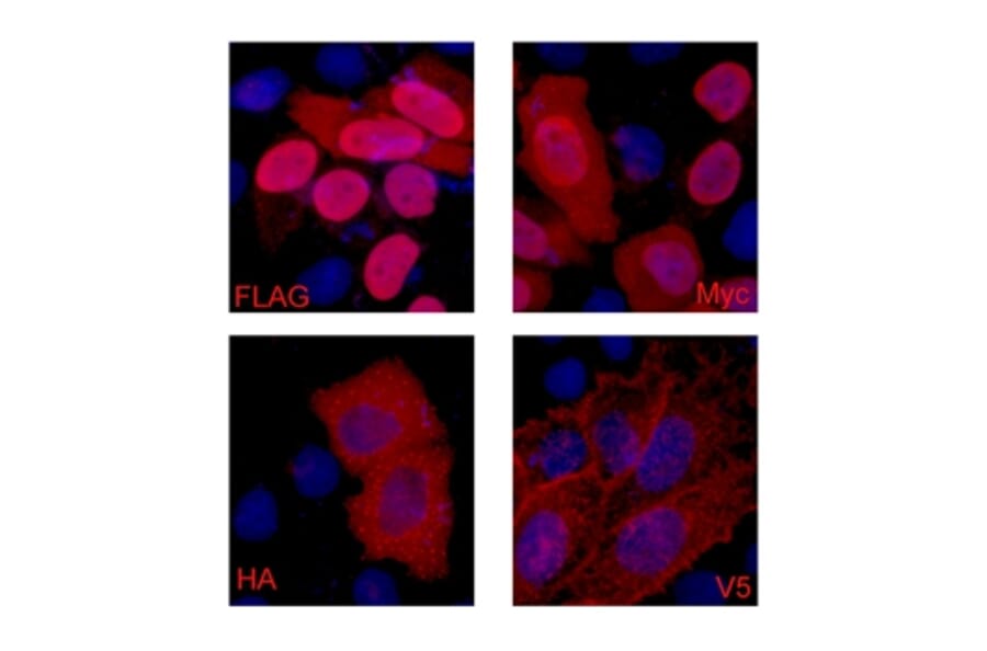 Flag-Tag Mouse Monoclonal Antibody from Signalway Antibody (T519) - Antibodies.com