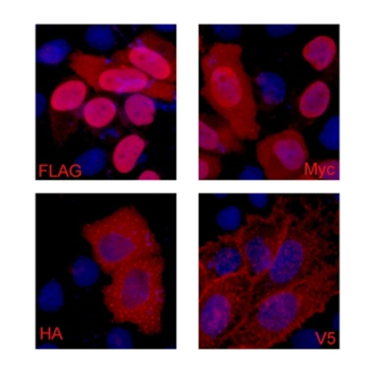 Flag-Tag Mouse Monoclonal Antibody from Signalway Antibody (T519) - Antibodies.com