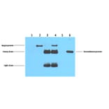 Flag-Tag Mouse Monoclonal Antibody from Signalway Antibody (T519) - Antibodies.com