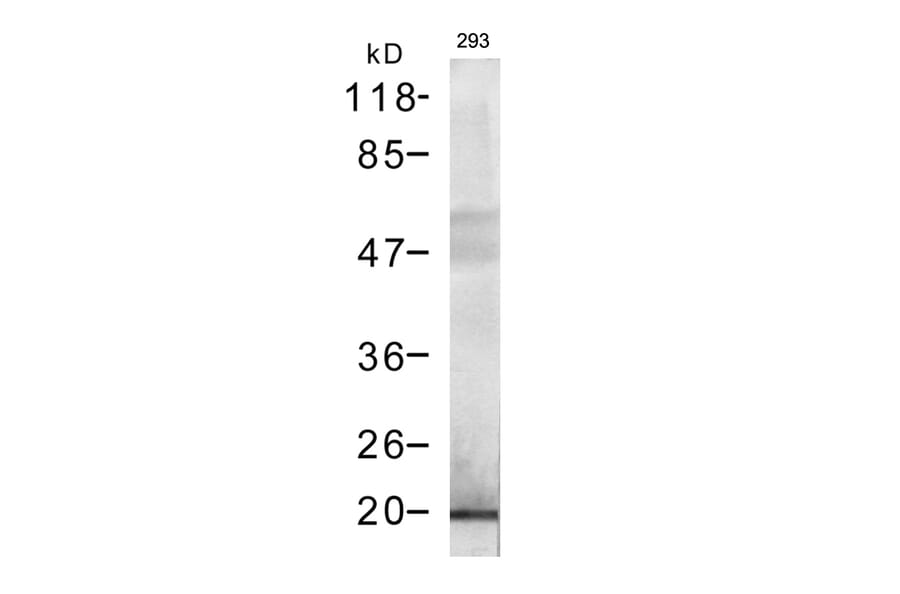 Western blot - DYKDDDDK-Tag Rabbit Polyclonal Antibody from Signalway Antibody (T503) - Antibodies.com