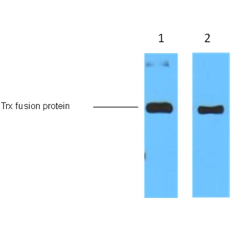 Trx-Tag Mouse Monoclonal Antibody from Signalway Antibody (T520) - Antibodies.com
