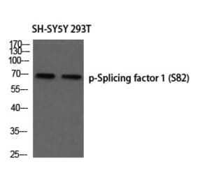 Western blot - Splicing factor 1 (Phospho-Ser82) Polyclonal Antibody from Signalway Antibody - Antibodies.com