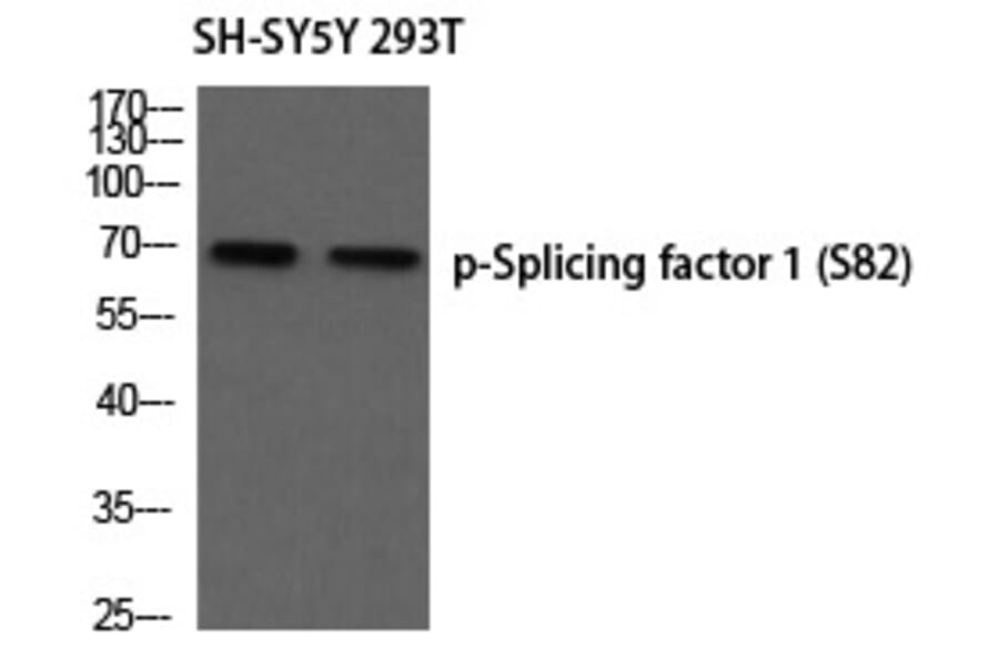 Western blot - Splicing factor 1 (Phospho-Ser82) Polyclonal Antibody from Signalway Antibody - Antibodies.com