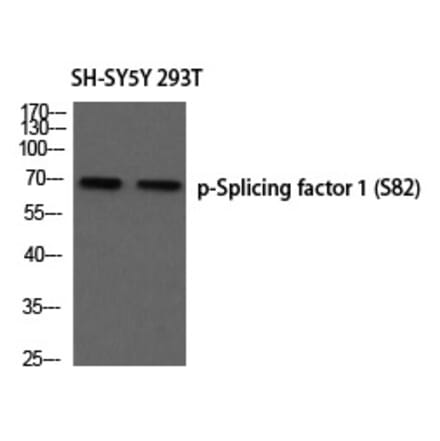 Western blot - Splicing factor 1 (Phospho-Ser82) Polyclonal Antibody from Signalway Antibody - Antibodies.com