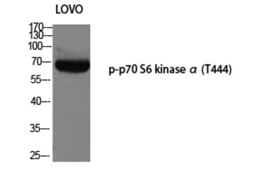 Western blot - p70 S6 kinase α (Phospho-Thr444) Polyclonal Antibody from Signalway Antibody - Antibodies.com