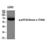Western blot - p70 S6 kinase α (Phospho-Thr444) Polyclonal Antibody from Signalway Antibody - Antibodies.com