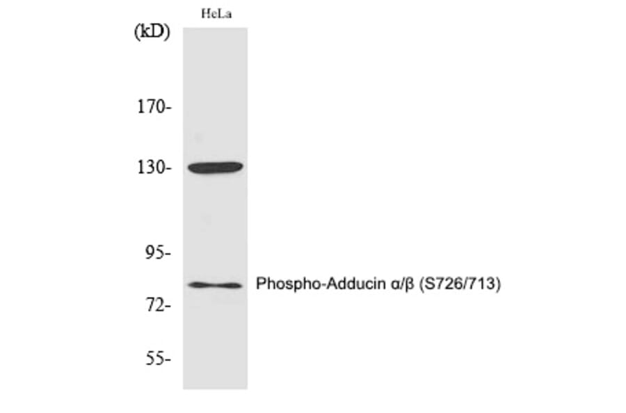 Western blot - Adducin α/β (Phospho-Ser726/713) Polyclonal Antibody from Signalway Antibody (12346)