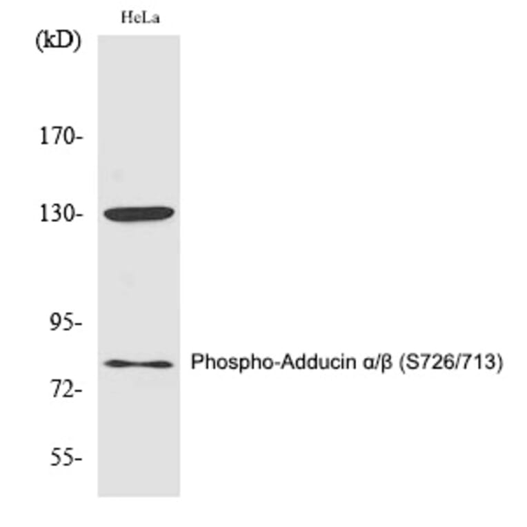 Western blot - Adducin α/β (Phospho-Ser726/713) Polyclonal Antibody from Signalway Antibody (12346)