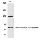 Western blot - Adducin α/β (Phospho-Ser726/713) Polyclonal Antibody from Signalway Antibody (12346)