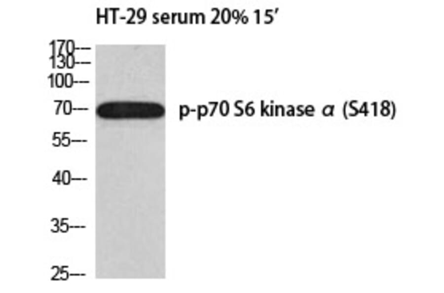 Western blot - p70 S6 kinase α (Phospho-Ser418) Polyclonal Antibody from Signalway Antibody - Antibodies.com